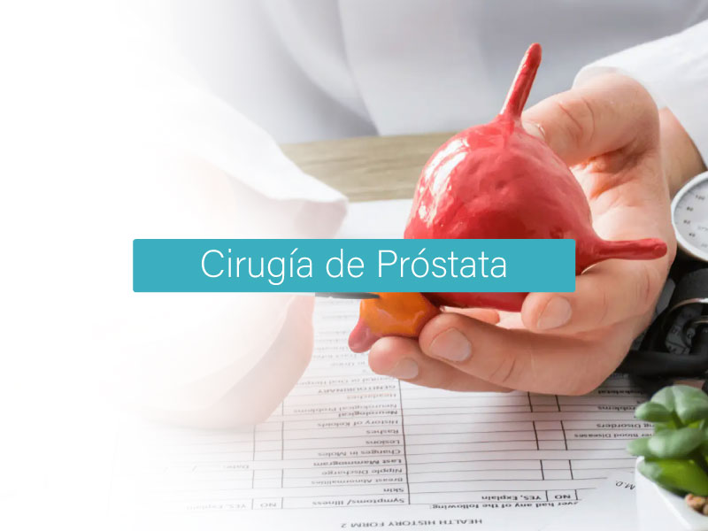 Dr.Alfredo Rodríguez Falconi | Urólogo
