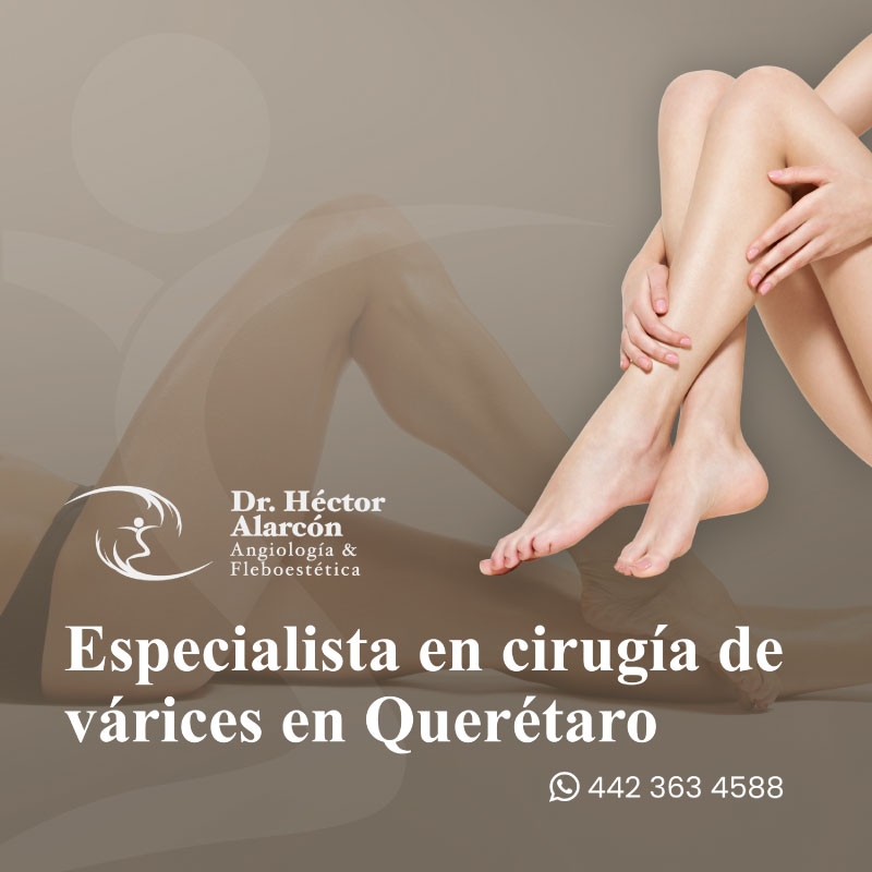 Fleboestética en Querétaro > Dr. Héctor Alarcón