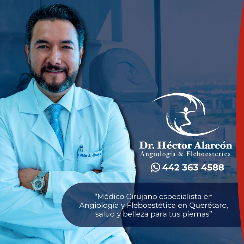 Especialista en Cirugía Vascular > Dr. Héctor Alarcón de la Peña
