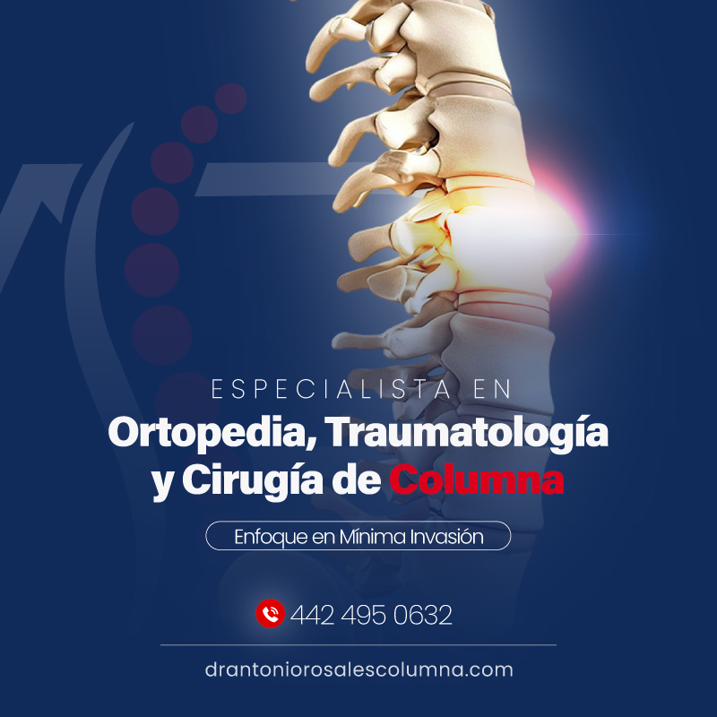 Especialista en Cirugía de Columna  ▷ Querétaro | Traumatología